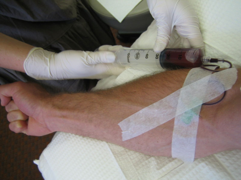 large syringe via IV